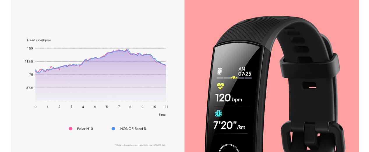 What Kind of Smart Band is More Attractive to Users